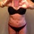 6 mos post