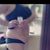 My before picture at a side view