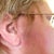 Rt ear, you can hardly see the scar.