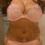 BEFORE: bikini, several months pre-op