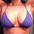 2 months post-op