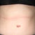Stomach 2