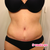 5 weeks po, no drain!!