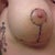2 Weeks Post Op RIGHT BREAST - Little more higher but feeling it starting to go down.