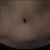 close up of scare and belly botton