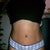 4 weeks. Just got stictches taken out of my belly button.