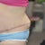 funky left over tissue on my side. Hoping to have this revised and smoothed out