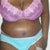 3wks post-op