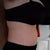 Side view 3 months post op.
