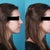 Before view, and computer imaging.