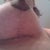 4 Weeks Post Op R Breast.  Notice very light scars.  Yay!!!