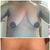 Comparing my Boobs Pre Op to 4 Weeks Post Op.