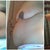 Comparing Side View from Pre Op May '12 before exercise to Pre Op Aug '12 after working out 3 months to 4 Weeks Post Op