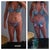 3 days post op...i am very pleased with the results so far...i know i'm going to shrink a lot more over the next few months too!