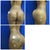 Wish Pic - Actual Patient results from Dr. Jimerson
