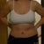 day 8 post op! I have ABS!! heheee