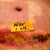Here it is after 1 week w/ the wet to dry dressings. It is looking worse but I expected it. I had stitches removed also so it could open up like it wanted to.
