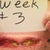 After 3 weeks. Now you can see the wound is coming together. Slowly but surely. I stopped fearing it would keep spreading at this point.