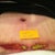 After 4 weeks. More healing.