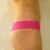 After surgery (side view) May 1,2012