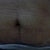 After the procedure