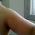 before upper arm liposuction