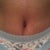 1 MO PO.. 5/3/12