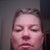 Noticeable drooping to left right side of face.