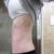 6 weeks post op