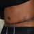 7 Days Post Op