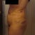 After (7 Days) - Right