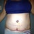 2 Days PO SWOLLEN!