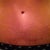 Scar after 1 and a half year mark