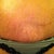 Close up of scar after year and a half still have low stretch marks :(