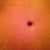 Close up of belly button, no scar at all!!!