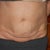 Frontal