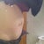 Lax tummy muscles.