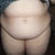 pre op front view