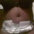 This is about 1 week PO