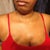AFTER UNDERARM