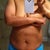 At 135 pounds (front view). Another 15 to lose before consult in May.