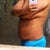 At 135 pounds (side view). Another 15 to lose before consult in May.