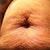 YUCKY!! Can't believe I'm uploading this :-)...At 120, this becomes worse (from my weightloss experience after my son). But nevertheless I need to get down to 120 before my consult in May. Despite how ugly this looks, I still would go through my pregnancies and have my wonderful kids if I had to do this all over again in another life :-)!!