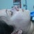 After surgery, right side (profile)