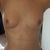 Before - Front View