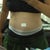 Day 6 swollen BAD