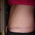 13 weeks....pants actually cover scar.