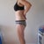 2 weeks post-op side view