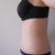 2 weeks post-op side view close-up