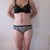 2 weeks post-op front view